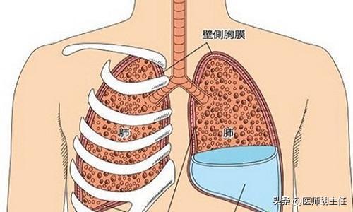 为什么建议做核磁共振（为什么不建议大家做）(11)