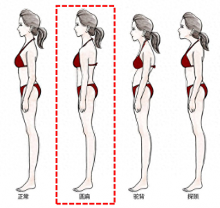 ​圆肩是什么肩？明星也有的体态问题，显胖显矮还拖累气质
