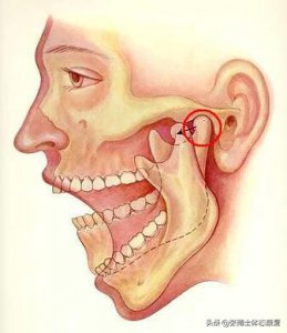 ​左下巴疼 「体态矫正」张嘴说话、咬东西下巴疼痛，试试这几个训练动作吧