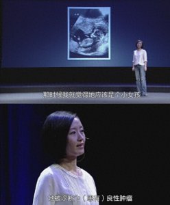 ​柴静复出曝女儿肿瘤出生即手术 22岁成央视文艺部副主任