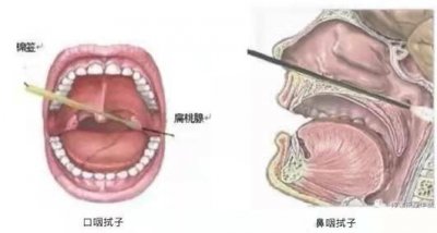 ​核酸阳性代表什么意思（核酸阳性≠确诊病例，区别是啥？疾控专家告诉你）