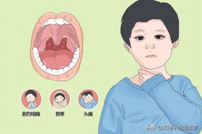 ​扁桃体发炎吃什么好得快一点（扁桃体炎？送你八味中药，清热利咽，热从二便出