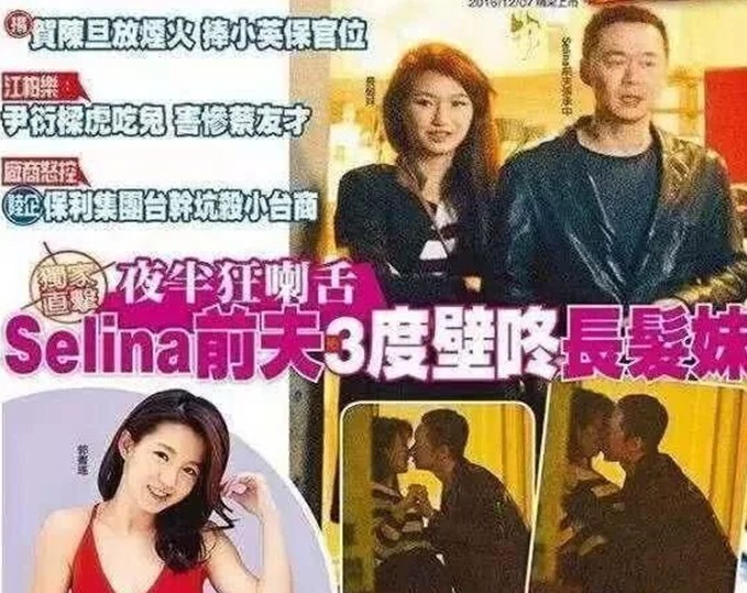 selina下面烧伤前夫称selina烧伤严重婚后根本不能同房