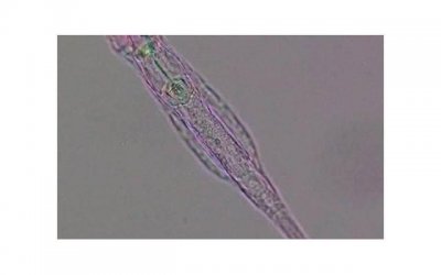 性单恋是不是回避型人格